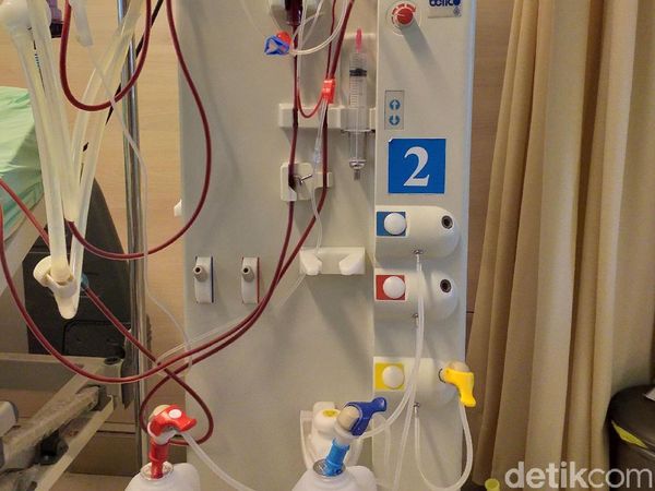 Mengenal Alat Cuci Darah yang Selangnya Sempat Jadi Heboh