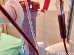 Bukan Selang! Ini Lho Bagian Alat Cuci Darah yang Bisa Dipakai Ulang
