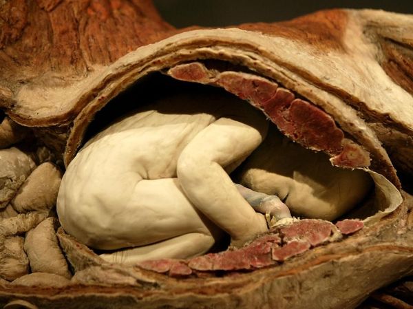 Pameran Ini Memajang Bayi Manusia Asli Ketika Masih dalam Kandungan