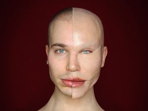 Bikin Tercengang, Selebgram Sukses Bohongi Follower dengan Mengaku Oplas