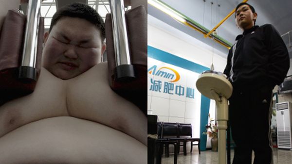 Transformasi Menakjubkan Remaja yang Sukses Turunkan 88 Kg Berat Badan