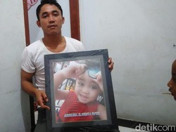 Orang Tua Bocah 2 Tahun Cerita Anaknya Dianiaya Orang Stres