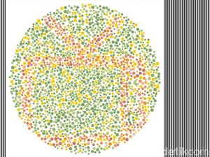 Tes Buta Warna! Gagal Temukan Gambar TV, Tandanya Harus Periksa