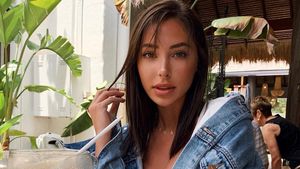 Foto Before-After Model yang Dituduh Vermak Wajah oleh Dokter Bedah Plastik