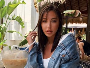 Foto Before-After Model yang Dituduh Vermak Wajah oleh Dokter Bedah Plastik