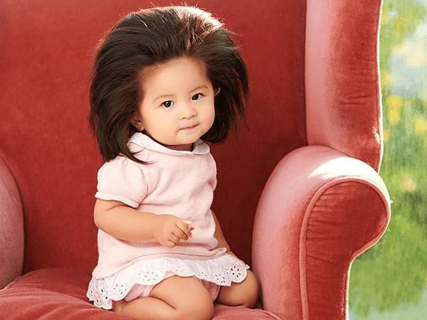 Cute! Bayi yang Dulu Viral karena Rambut Super Tebal, Kini Jadi Model Sampo
