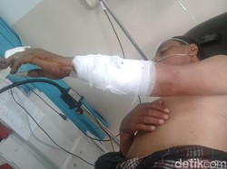 Cemburu, Warga Boyolali Bacok Pria yang Minta Kerok ke Istrinya