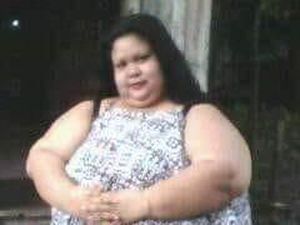Titi Wati Wanita 220 Kg, Pernah Jalani Operasi Bariatrik Sebelum Ngetren