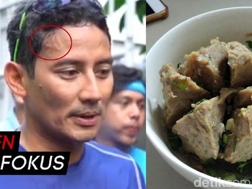 Ada di Bakso dan Pelipis Sandiaga, Sebenarnya Urat Itu Apa Sih? Ada di Bakso dan Pelipis Sandiaga, Sebenarnya Urat Itu Apa Sih?