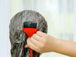 Miris, Seluruh Kepala Wanita Ini Bengkak Akibat Alergi Cat Rambut