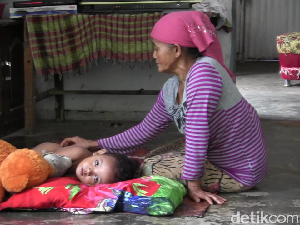 Empat Balita Jadi Korban Serangan Monyet Liar di Lumajang