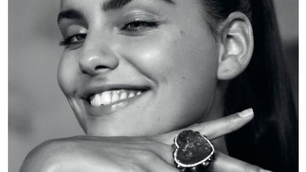 Pesona Si Cantik Moffy, Model Langka yang Punya Mata Juling