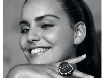 Pesona Si Cantik Moffy, Model Langka yang Punya Mata Juling
