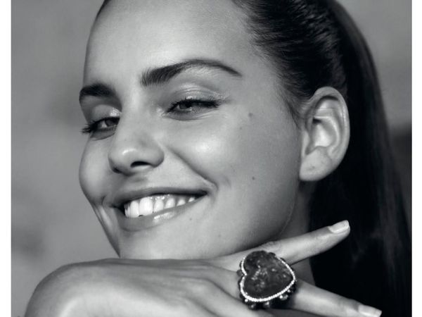 Pesona Si Cantik Moffy, Model Langka yang Punya Mata Juling