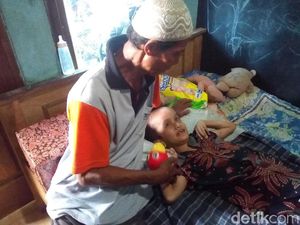 Tolong! Dua Bocah Satu Desa di Kudus Ini Derita Hidrosefalus