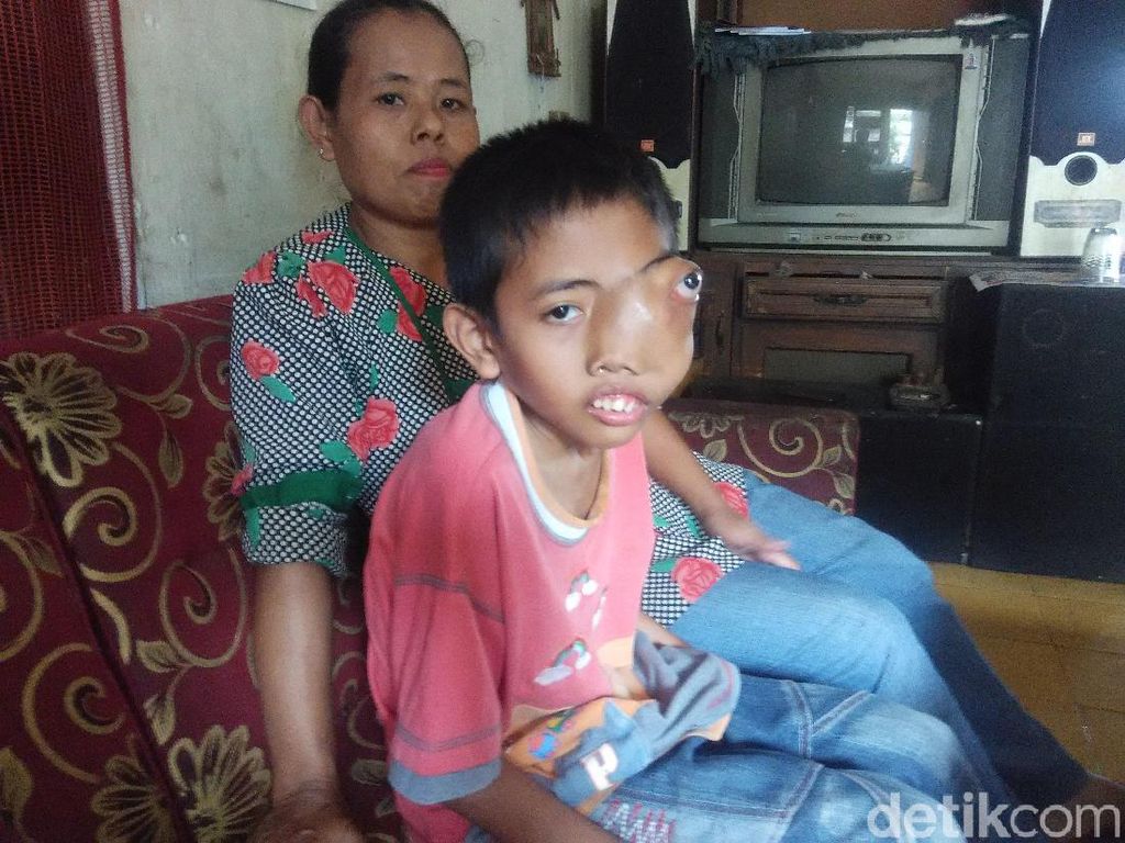 Semangat Bocah Padalarang Melawan Tumor Sinonasal Semangat Bocah Padalarang Melawan Tumor Sinonasal