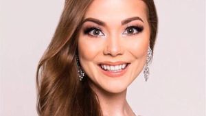 Terpikat Pesona Ratu Kecantikan yang Hanya Memiliki Satu Tangan