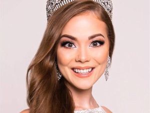 Terpikat Pesona Ratu Kecantikan yang Hanya Memiliki Satu Tangan