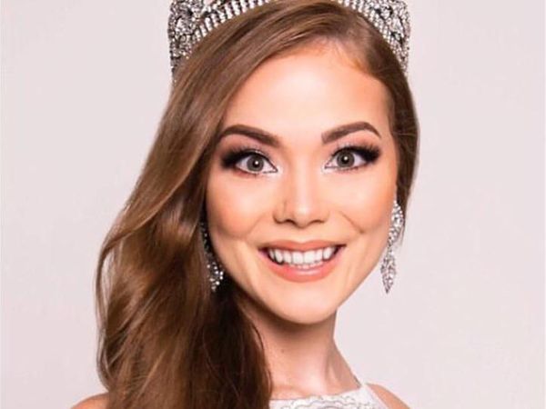 Terpikat Pesona Ratu Kecantikan yang Hanya Memiliki Satu Tangan