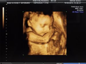 Alasan di Balik Janin Lebih Sering Gerak di Trimester Tiga