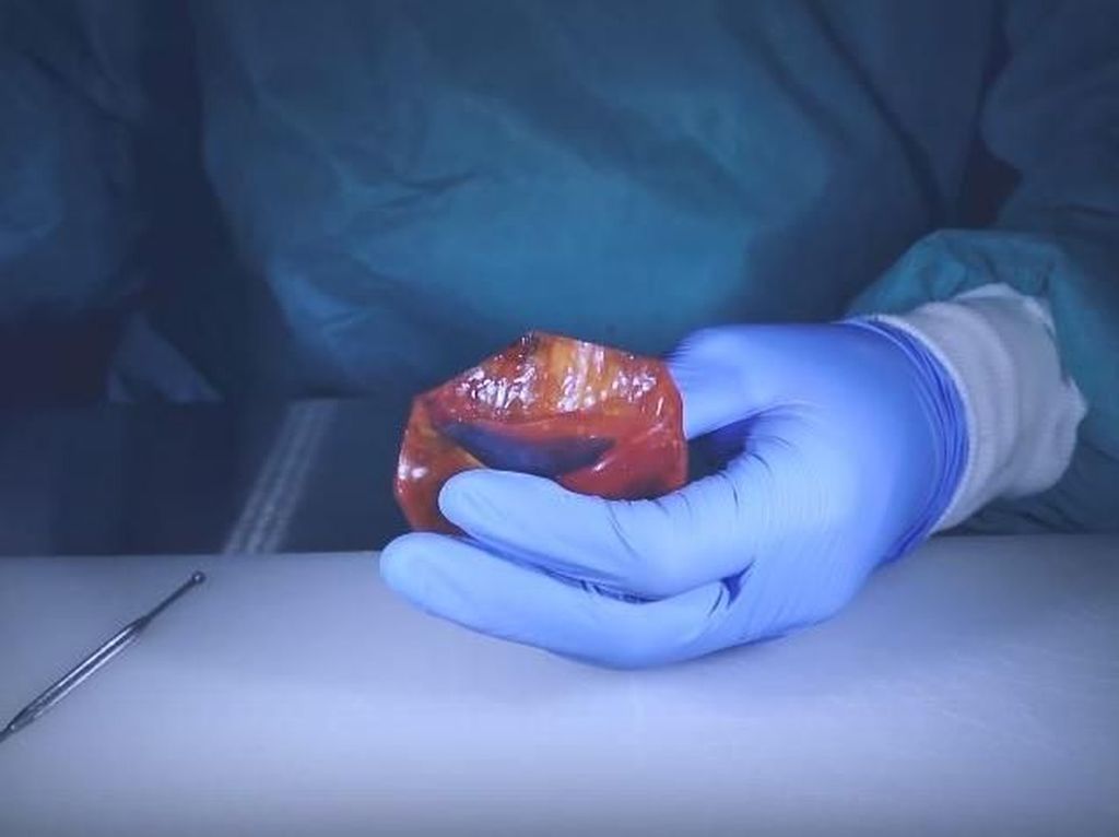Keren! Dokter Ini Lakukan Operasi Bedah Beragam Jenis Buah Keren! Dokter Ini Lakukan Operasi Bedah Beragam Jenis Buah