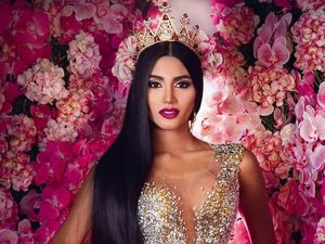 Foto: Pemenang Ketiga Miss Universe 2018 yang Dihujat karena Operasi Plastik