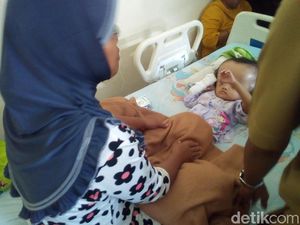 Sejak Lahir, Bocah 3 Tahun di Kudus Ini Menderita Hidrosefalus