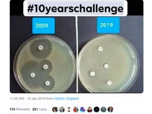 10 Years Challenge yang Ini Bikin Takut Minum Antibiotik 10 Years Challenge yang Ini Bikin Takut Minum Antibiotik