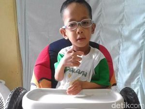 Kanzu dan Perjuangannya Lawan Penyakit Super Langka di Dunia