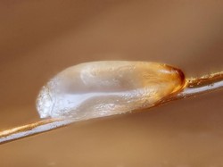 Begini Nih Penampakan Telur Kutu di Sehelai Rambut Manusia