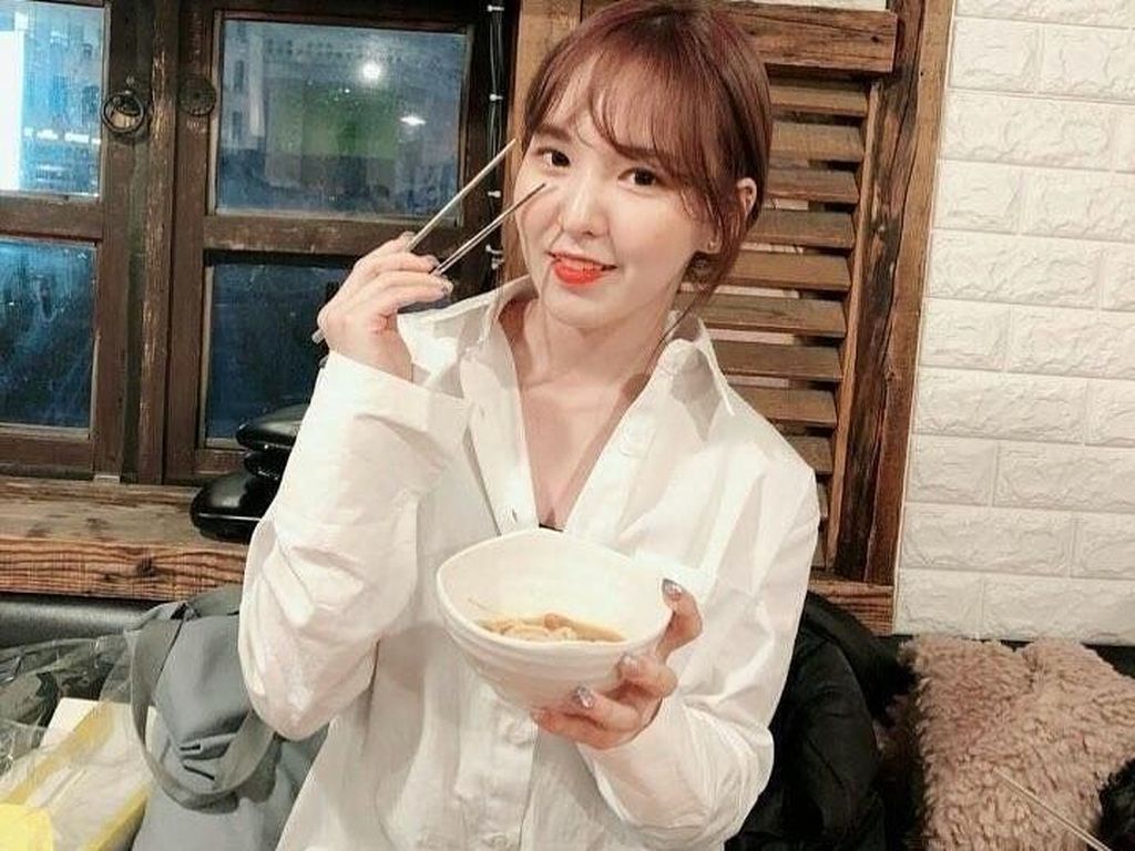 Wendy Red Velvet Jatuh dan Patah Tulang, Berapa Lama Penyembuhannya? Wendy Red Velvet Jatuh dan Patah Tulang, Berapa Lama Penyembuhannya?