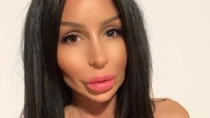 Kegilaan Operasi Plastik, Wajah Wanita Ini Disebut Mirip Monster