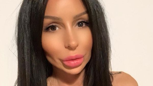 Kegilaan Operasi Plastik, Wajah Wanita Ini Disebut Mirip Monster