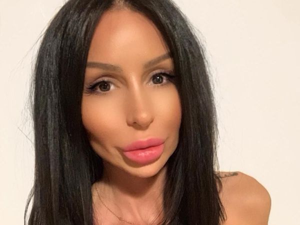 Kegilaan Operasi Plastik, Wajah Wanita Ini Disebut Mirip Monster