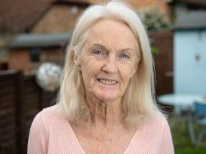 Kisah Nenek yang Berani Ambil Risiko Kematian, Operasi Face Lift di Usia 80