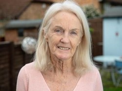 Kisah Nenek yang Berani Ambil Risiko Kematian, Operasi Face Lift di Usia 80