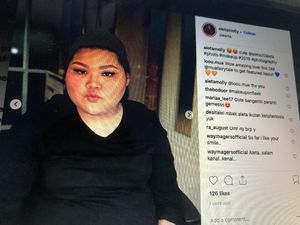 6 Fakta Aleta Molly yang Beri Hotman Paris Berlian