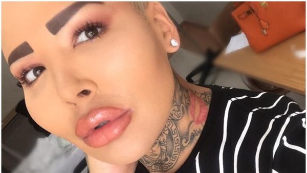 Penampilan Mengerikan Pria yang 50 Kali Oplas Demi Mirip Kim Kardashian