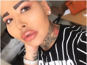 Penampilan Mengerikan Pria yang 50 Kali Oplas Demi Mirip Kim Kardashian