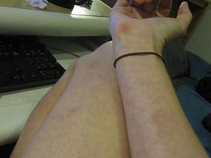 Flu Tulang Adalah: Gejala, Penyebab, dan Cara Mencegah