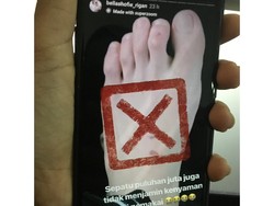 Sepatu Puluhan Juta Bikin Kaki Bella Shofie Lecet, Apa Penyebabnya?