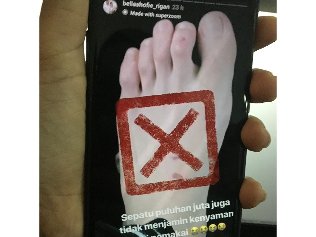 Sepatu Puluhan Juta Bikin Kaki Bella Shofie Lecet, Apa Penyebabnya? Sepatu Puluhan Juta Bikin Kaki Bella Shofie Lecet, Apa Penyebabnya?