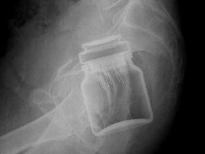 Ponsel hingga Stoples Selai, Ini 10 Benda Aneh yang Ditemukan dalam Tubuh Manusia