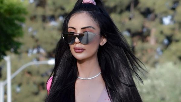Penampilan Model yang Habiskan Rp 7 Miliar untuk 20 Kali Operasi Plastik