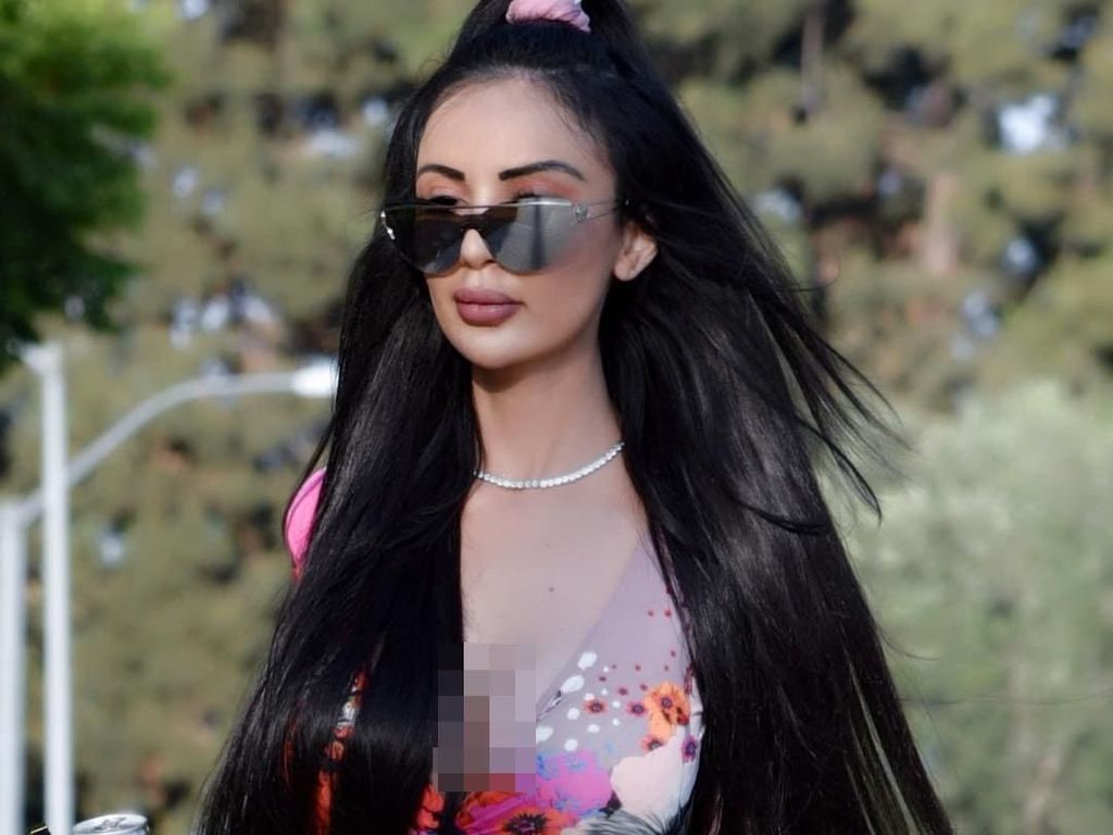 Model Ini Habiskan Rp 9 M untuk Oplas Demi Mirip Kim Kardashian, Berakhir Menyesal