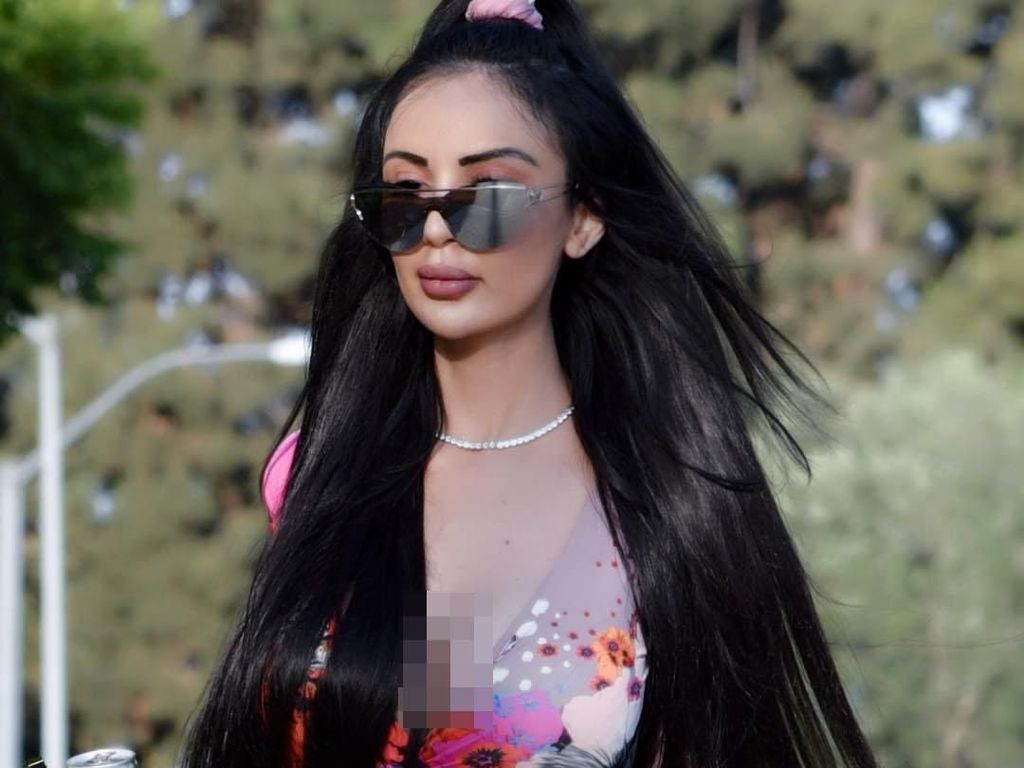 Model Ini Habiskan Rp 9 M untuk Oplas Demi Mirip Kim Kardashian, Berakhir Menyesal Model Ini Habiskan Rp 9 M untuk Oplas Demi Mirip Kim Kardashian, Berakhir Menyesal