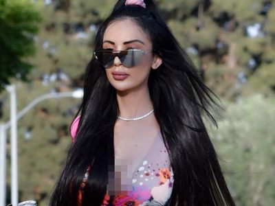 Penampilan Model yang Habiskan Rp 7 Miliar untuk 20 Kali Operasi Plastik