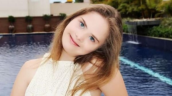Potret Gadis Down Syndrome yang Dikontrak 5 Agensi Model Setelah Viral