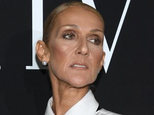 Pujian Netizen untuk Celine Dion yang Berani Hapus Makeup di Video Klip Pujian Netizen untuk Celine Dion yang Berani Hapus Makeup di Video Klip