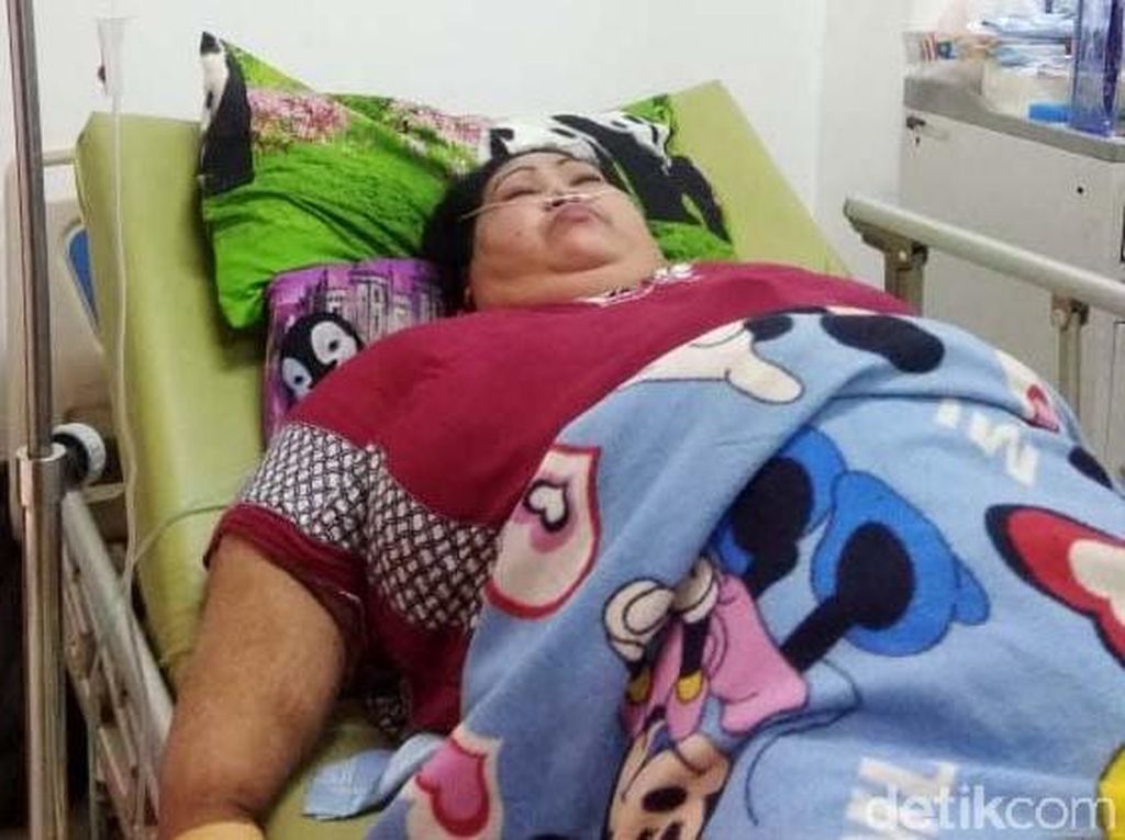 Berbobot 148 Kg, Sunarti Dirawat di RSUD Karawang Berbobot 148 Kg, Sunarti Dirawat di RSUD Karawang